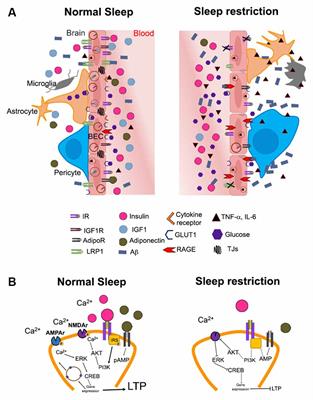 Metabolic Disturbances Induced by Sleep Restriction as Potential Triggers for Alzheimer’s Disease